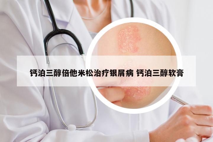 钙泊三醇倍他米松治疗银屑病 钙泊三醇软膏